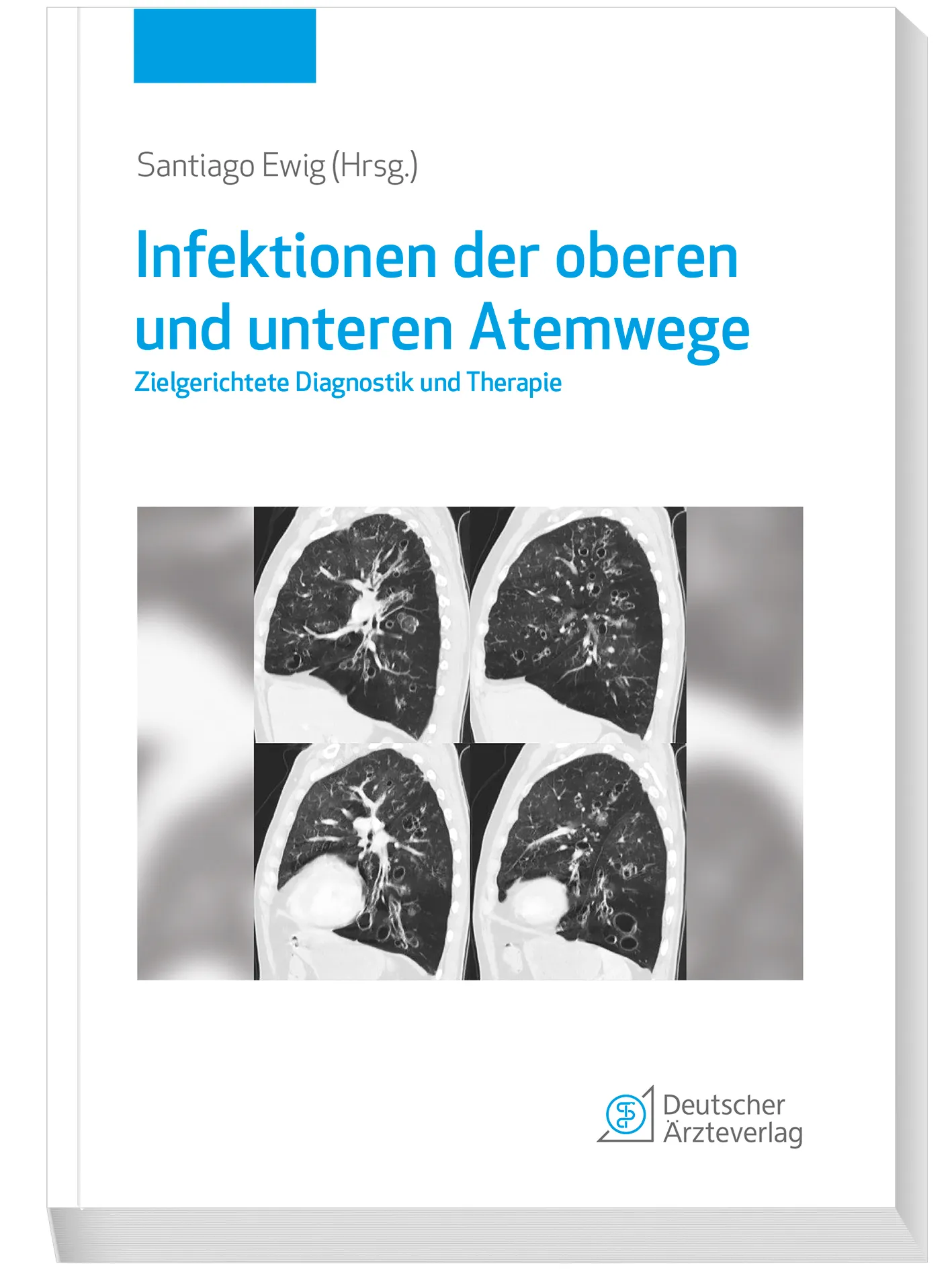 Infektionen der oberen und unteren Atemwege Infektionen der oberen und unteren Atemwege