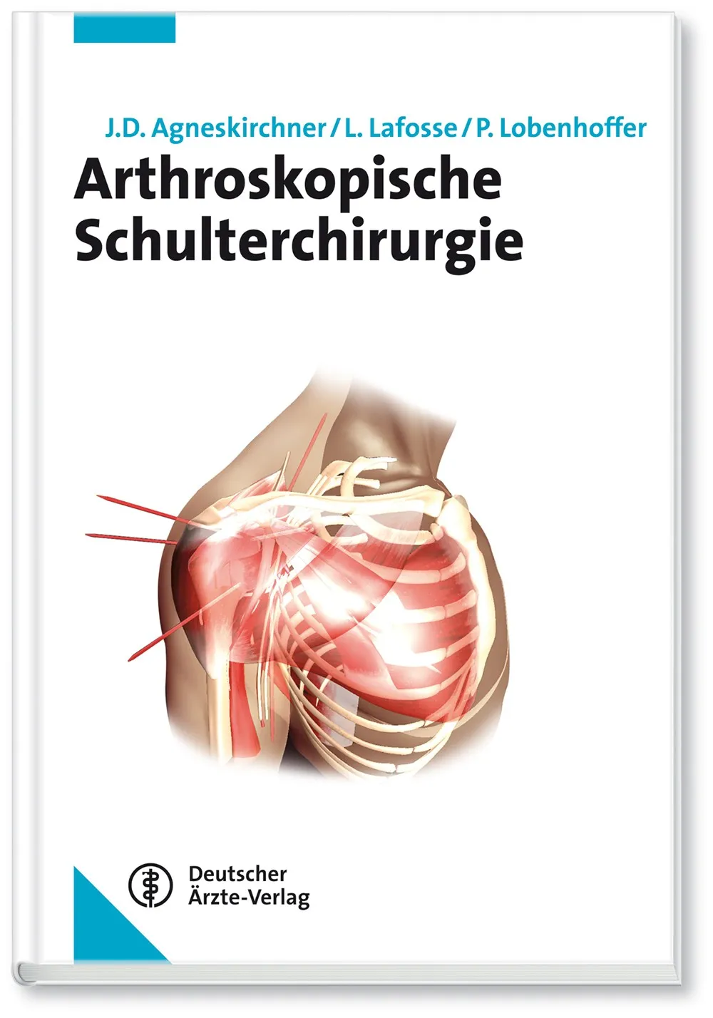 Arthroskopische Schulterchirurgie - eBook Arthroskopische Schulterchirurgie - eBook