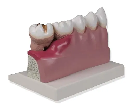 Dentalmodell, 4-fache Größe Dentalmodell, 4-fache Größe